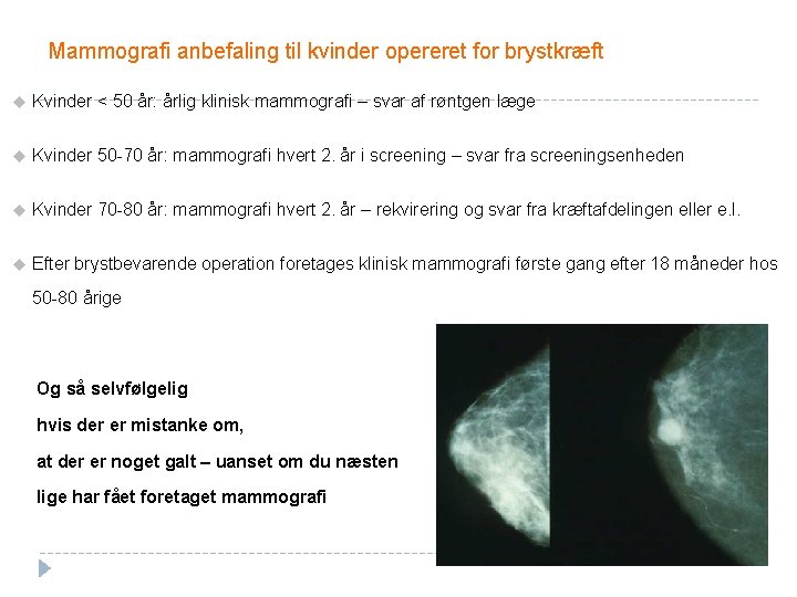 Mammografi anbefaling til kvinder opereret for brystkræft u Kvinder < 50 år: årlig klinisk