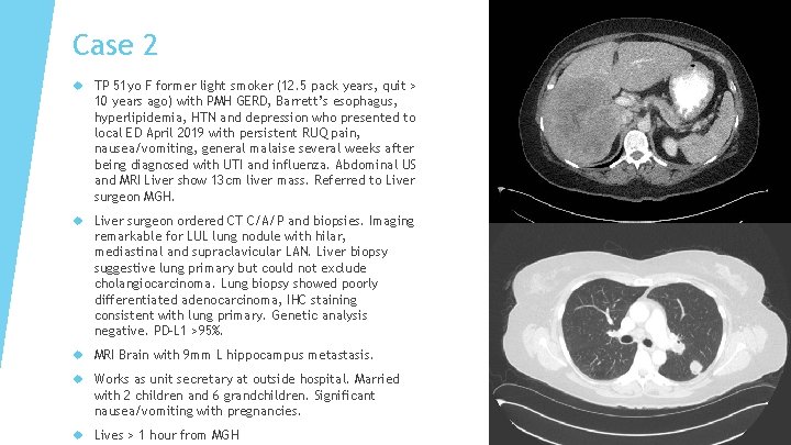 Case 2 TP 51 yo F former light smoker (12. 5 pack years, quit