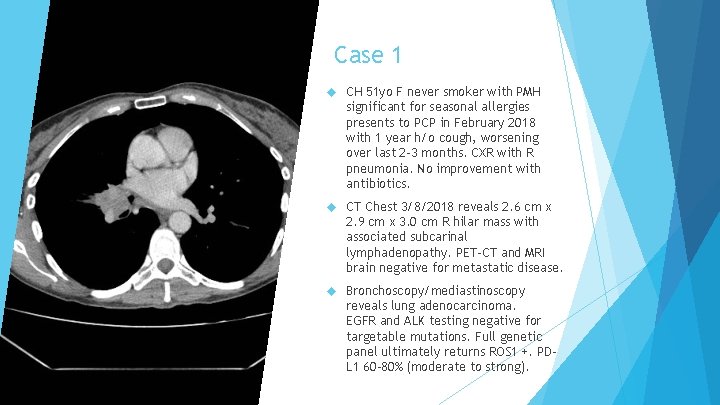 Case 1 CH 51 yo F never smoker with PMH significant for seasonal allergies