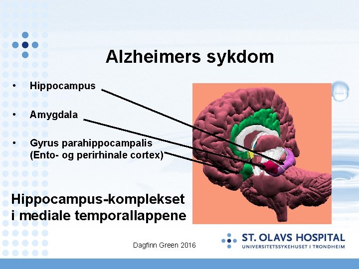Alzheimers sykdom • Hippocampus • Amygdala • Gyrus parahippocampalis (Ento- og perirhinale cortex) Hippocampus-komplekset