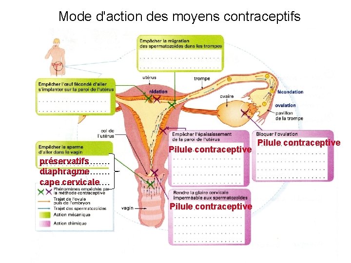 Mode d'action des moyens contraceptifs Pilule contraceptive préservatifs ………… diaphragme ………… cape ………… cervicale