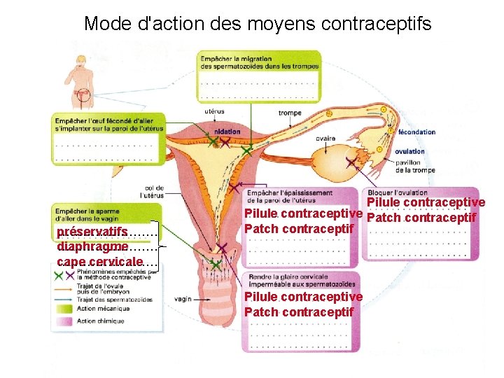 Mode d'action des moyens contraceptifs préservatifs ………… diaphragme ………… cape ………… cervicale Pilule contraceptive