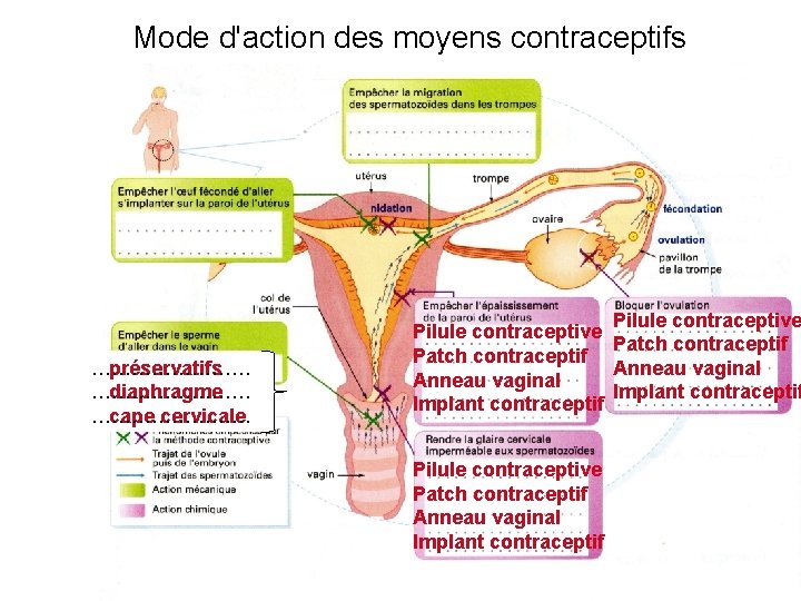 Mode d'action des moyens contraceptifs ………… préservatifs ………… diaphragme ………… cape cervicale Pilule contraceptive