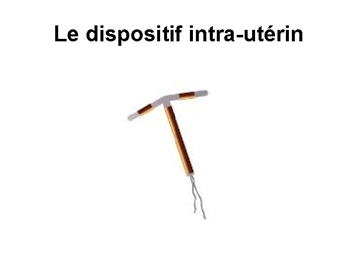 Le dispositif intra-utérin 