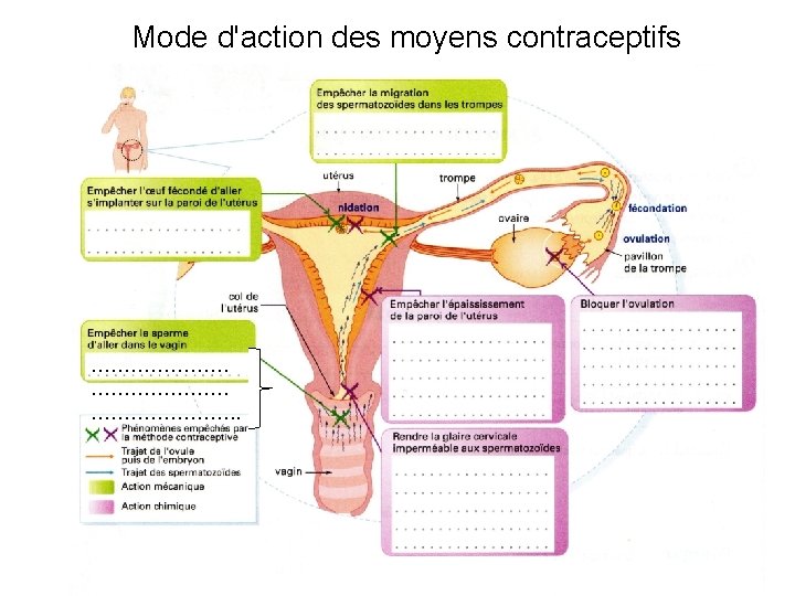 Mode d'action des moyens contraceptifs …………………. . 