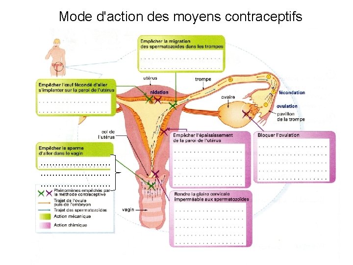 Mode d'action des moyens contraceptifs …………………… 