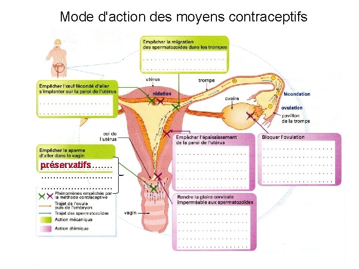 Mode d'action des moyens contraceptifs préservatifs …………………… 