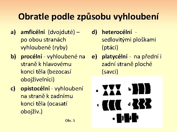Obratle podle způsobu vyhloubení a) amficélní (dvojduté) – d) heterocélní - po obou stranách