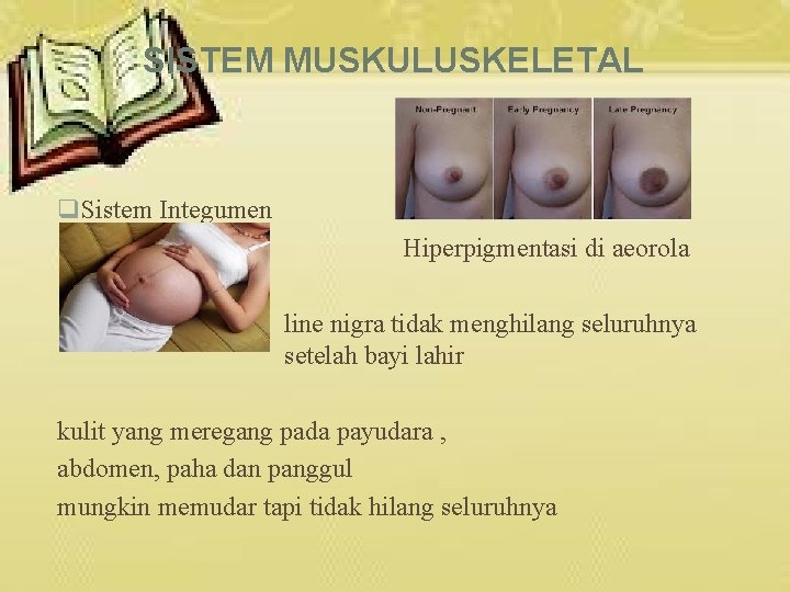 SISTEM MUSKULUSKELETAL q. Sistem Integumen Hiperpigmentasi di aeorola line nigra tidak menghilang seluruhnya setelah