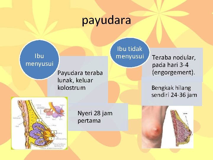 payudara Ibu tidak menyusui Ibu menyusui Payudara teraba lunak, keluar kolostrum Nyeri 28 jam