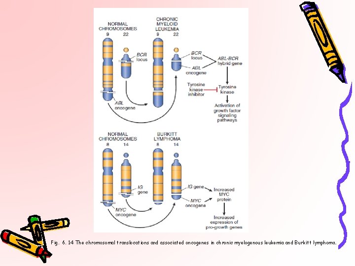 Fig. 6. 14 The chromosomal translocations and associated oncogenes in chronic myelogenous leukemia and