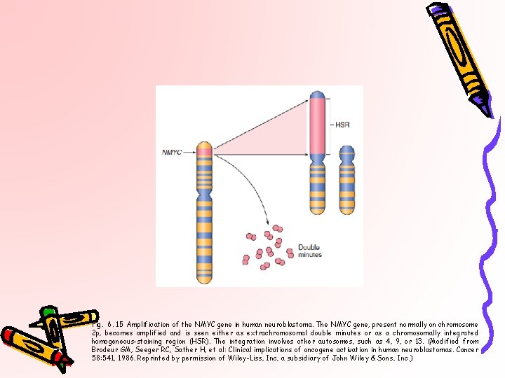Fig. 6. 15 Amplification of the NMYC gene in human neuroblastoma. The NMYC gene,