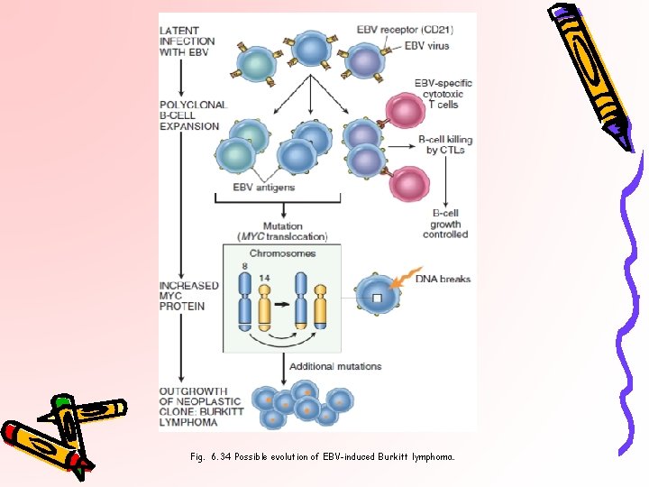 Fig. 6. 34 Possible evolution of EBV-induced Burkitt lymphoma. 