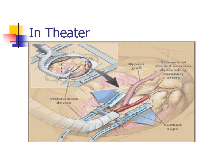 In Theater 