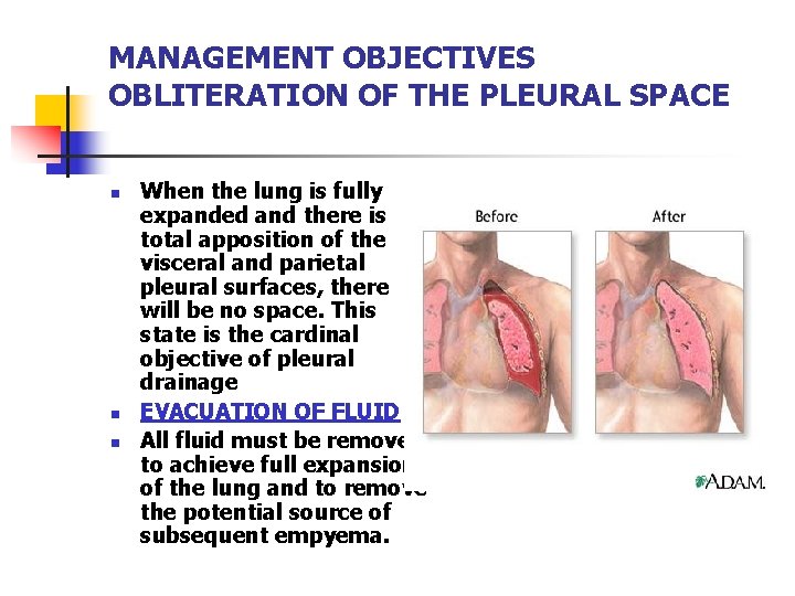 MANAGEMENT OBJECTIVES OBLITERATION OF THE PLEURAL SPACE n n n When the lung is