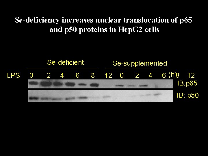 Se-deficiency increases nuclear translocation of p 65 and p 50 proteins in Hep. G
