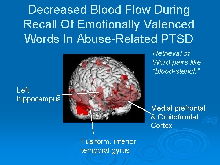 Decreased Blood Flow During Recall Of Emotionally Valenced Words In Abuse-Related PTSD Retrieval of