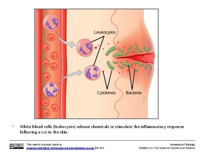  • White blood cells (leukocytes) release chemicals to stimulate the inflammatory response following