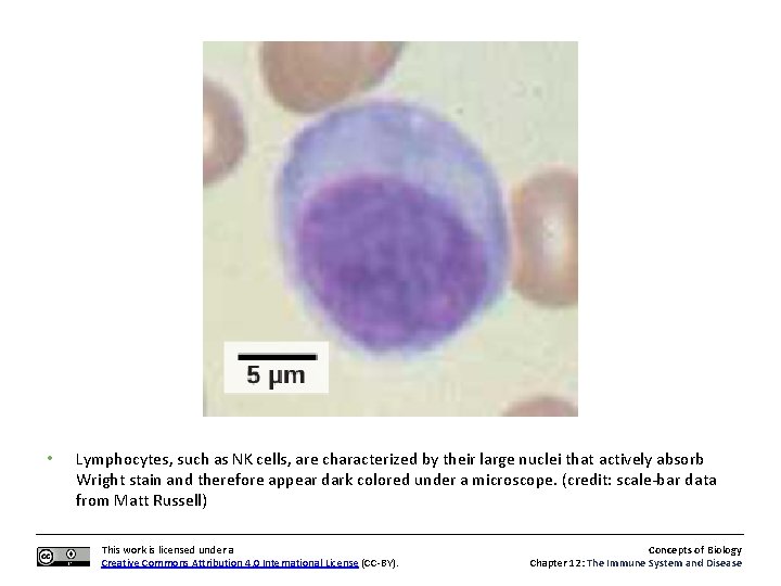 • Lymphocytes, such as NK cells, are characterized by their large nuclei that