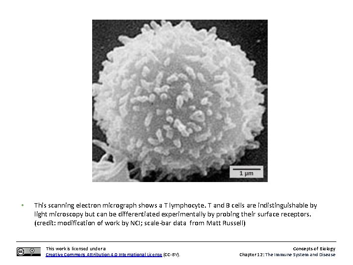  • This scanning electron micrograph shows a T lymphocyte. T and B cells
