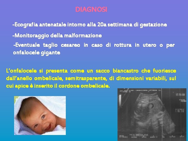 DIAGNOSI -Ecografia antenatale intorno alla 20 a settimana di gestazione -Monitoraggio della malformazione -Eventuale