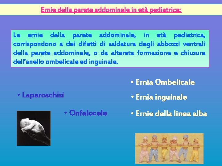 Ernie della parete addominale in età pediatrica: Le ernie della parete addominale, in età