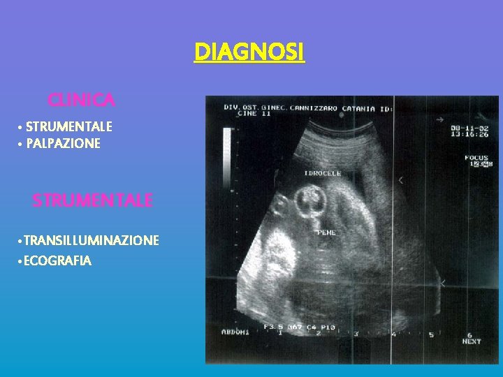 DIAGNOSI CLINICA • STRUMENTALE • PALPAZIONE STRUMENTALE • TRANSILLUMINAZIONE • ECOGRAFIA 