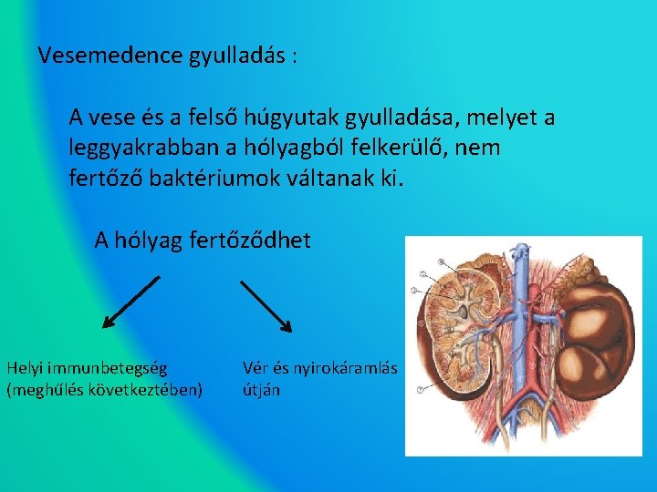 Vesemedence gyulladás : A vese és a felső húgyutak gyulladása, melyet a leggyakrabban a