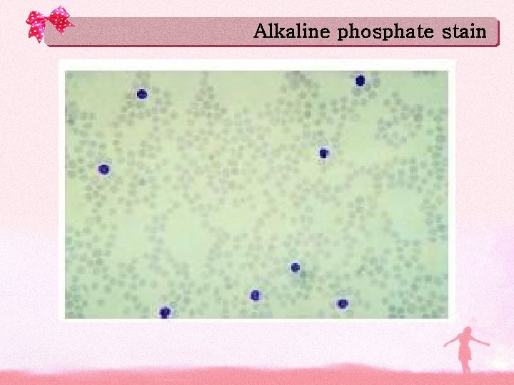 Alkaline phosphate stain 