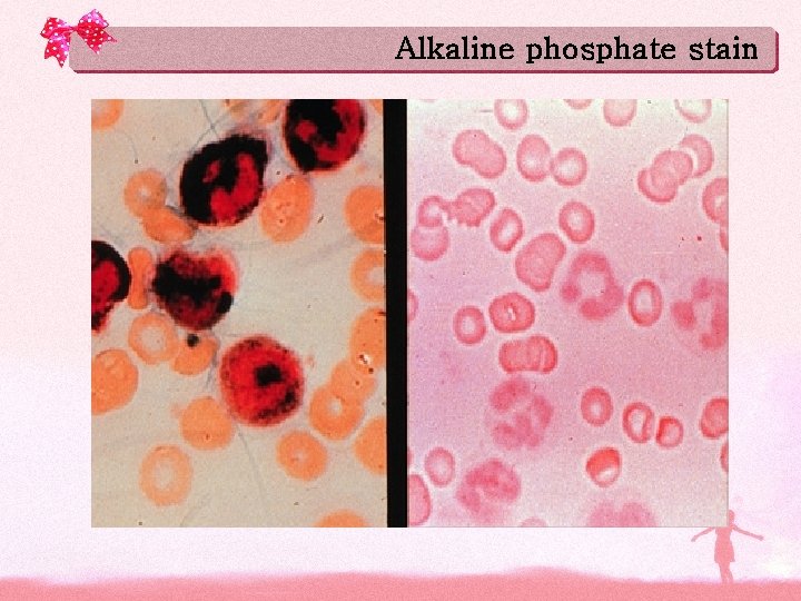 Alkaline phosphate stain 