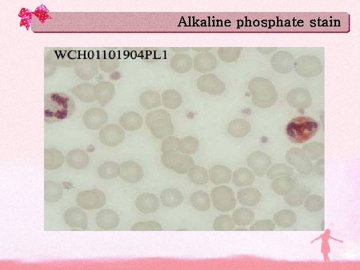 Alkaline phosphate stain 