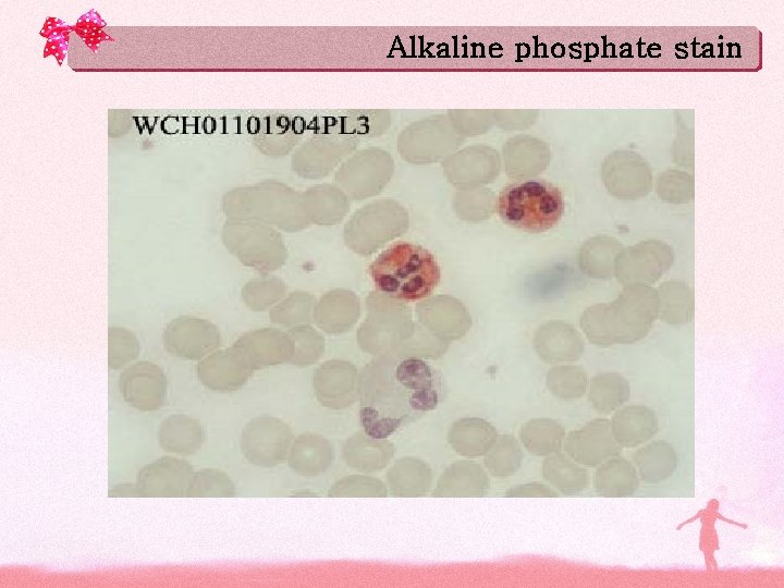 Alkaline phosphate stain Alkaline phosphate stain