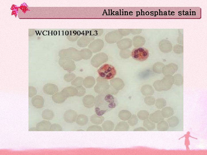 Alkaline phosphate stain 