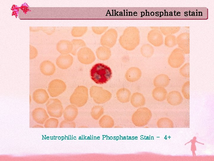 Alkaline phosphate stain Neutrophilic alkaline Phosphatase Stain - 4+ Alkaline phosphate stain Neutrophilic alkaline Phosphatase Stain - 4+