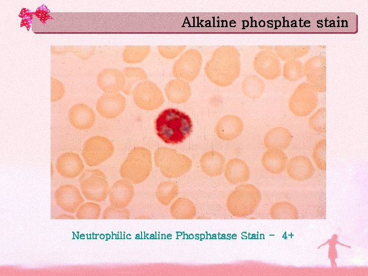 Alkaline phosphate stain Neutrophilic alkaline Phosphatase Stain - 4+ 