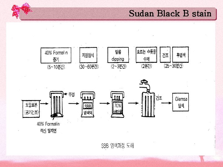 Sudan Black B stain Sudan Black B stain