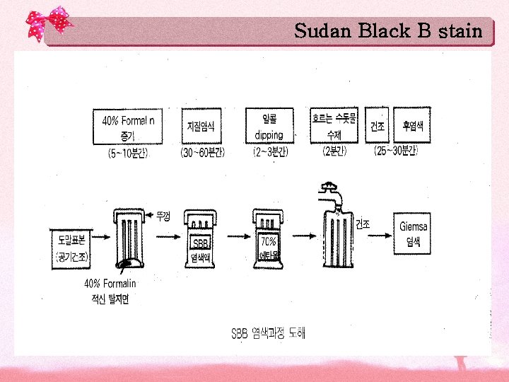 Sudan Black B stain 