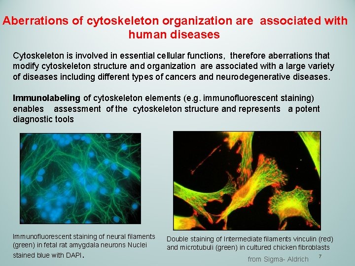 Aberrations of cytoskeleton organization are associated with human diseases Cytoskeleton is involved in essential