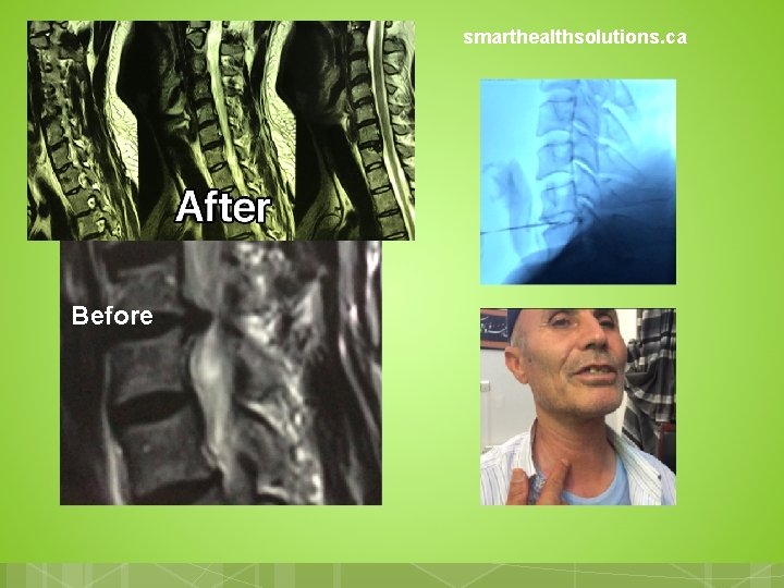 smarthealthsolutions. ca Before 