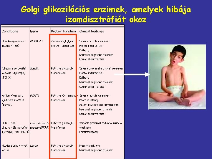 Golgi glikozilációs enzimek, amelyek hibája izomdisztrófiát okoz 