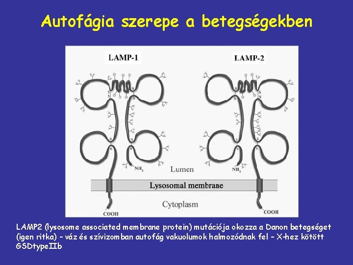 Autofágia szerepe a betegségekben LAMP 2 (lysosome associated membrane protein) mutációja okozza a Danon