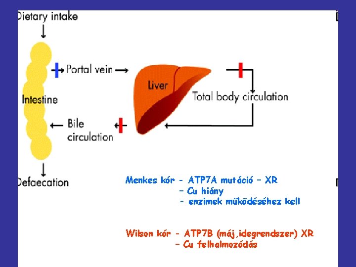 Menkes kór - ATP 7 A mutáció – XR – Cu hiány - enzimek