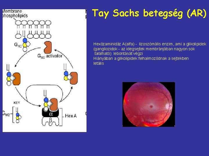 Tay Sachs betegség (AR) Hexózaminidáz A(alfa) - lizoszómális enzim, ami a glikolipidek (gangliozidok -