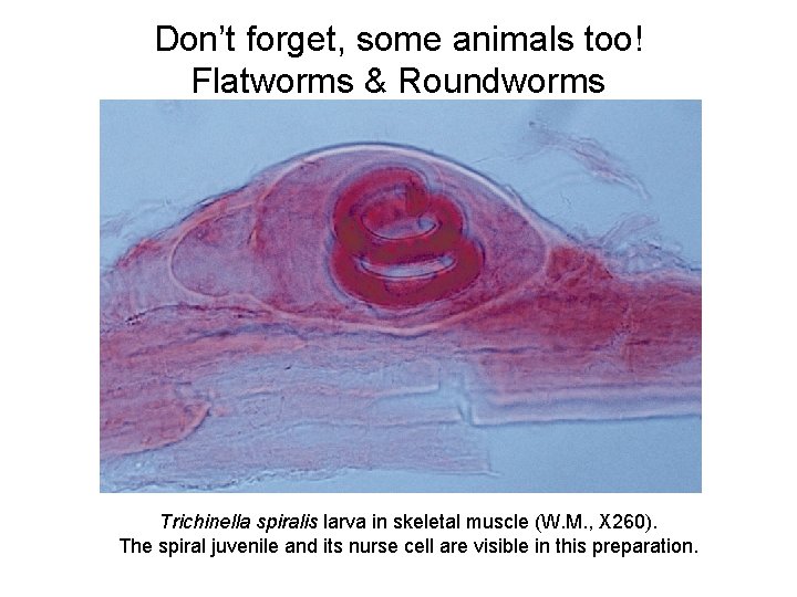 Don’t forget, some animals too! Flatworms & Roundworms Trichinella spiralis larva in skeletal muscle