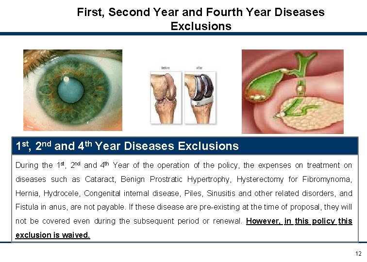 First, Second Year and Fourth Year Diseases Exclusions 1 st, 2 nd and 4