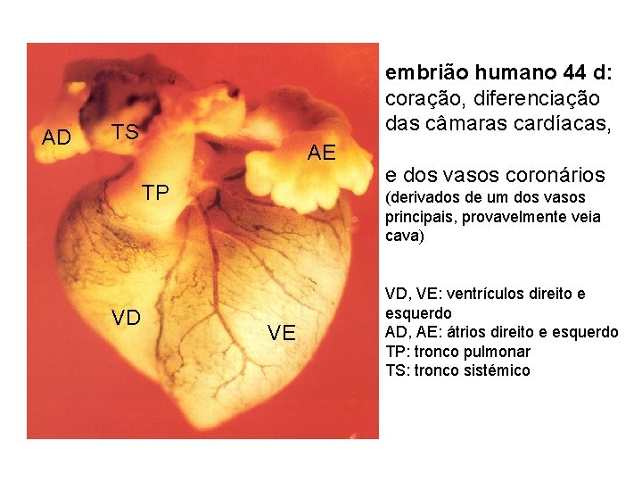 AD embrião humano 44 d: coração, diferenciação das câmaras cardíacas, TS AE TP VD