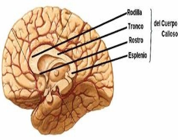 Partes del cuerpo calloso 