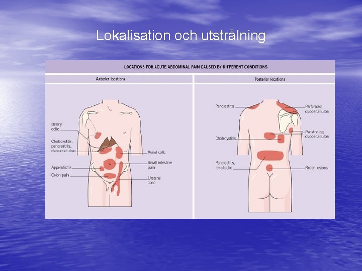 Lokalisation och utstrålning 