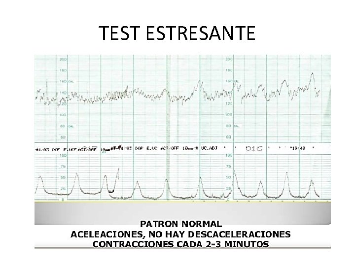 TEST ESTRESANTE 