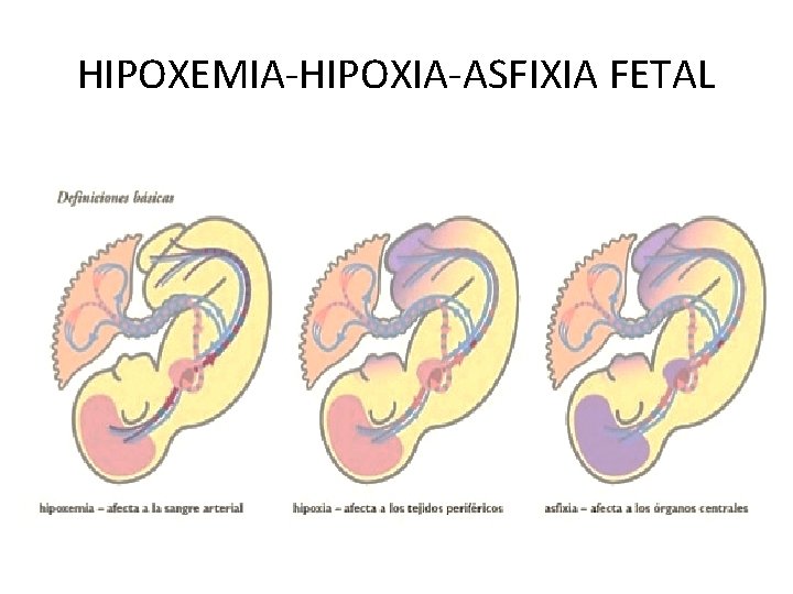 HIPOXEMIA-HIPOXIA-ASFIXIA FETAL 